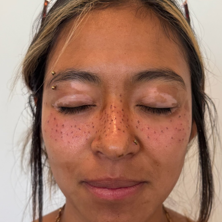 Permenant Makeup pmu freckles